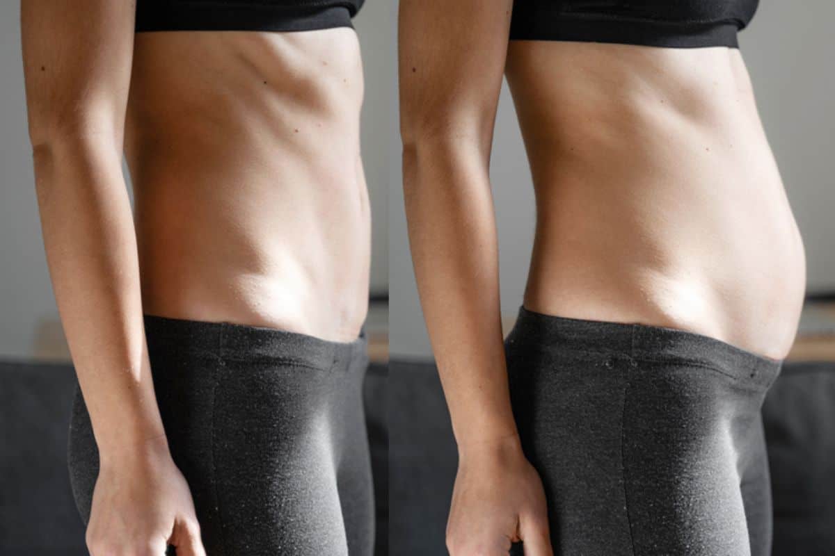 How long does diastasis recti take to improve Kingston Hill?