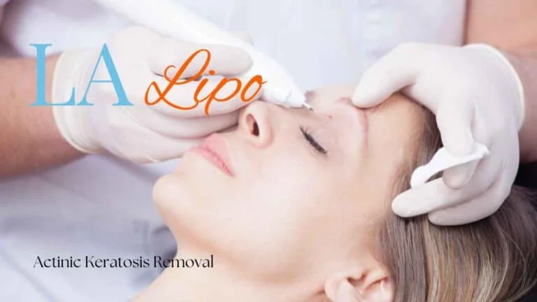 Woman receiving Actinic Keratosis Removal Treatment Kingston Hill
