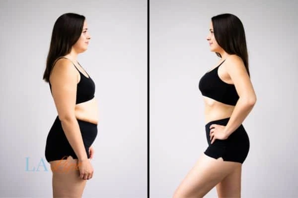 LA-EMS Body Sculpting Kingston Hill results before and after of womans results on body toning.