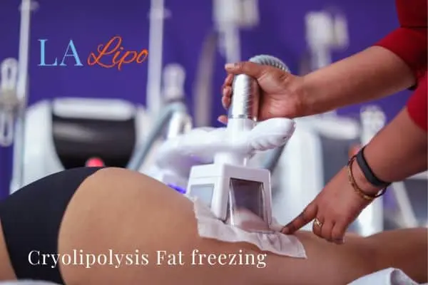 women getting fat freezing Kingston Hill