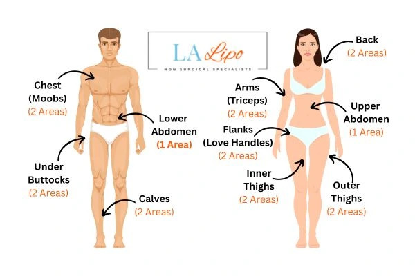 LA LIPO Cryolipolysis Areas Kingston Hill