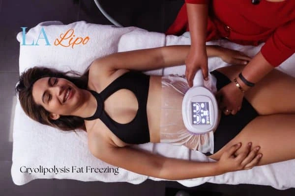 woman getting cryolipolysis Kingston Hill
