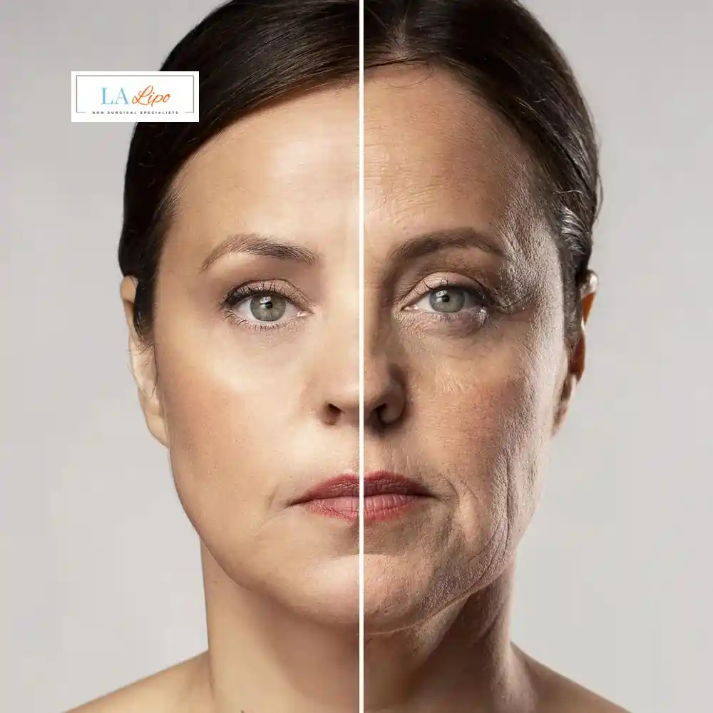 How Can You Tell If Non-Surgical Skin Tightening Is Right for You Kingston Hill?