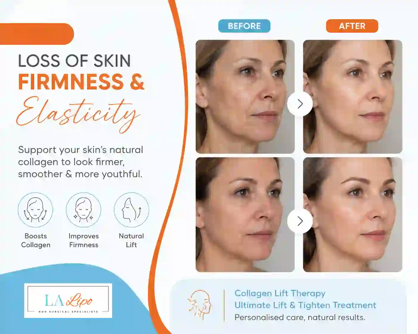 Sign #7: Loss of Skin Firmness and Elasticity Kingston Hill
