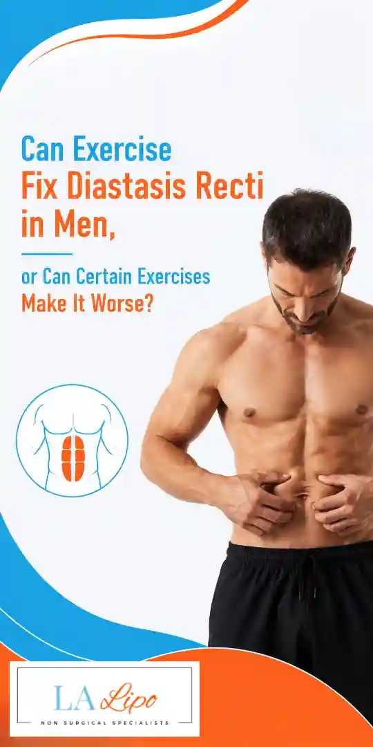 Can Exercise Fix Diastasis Recti in Men, or Can Certain Exercises Make It Worse Kingston Hill?