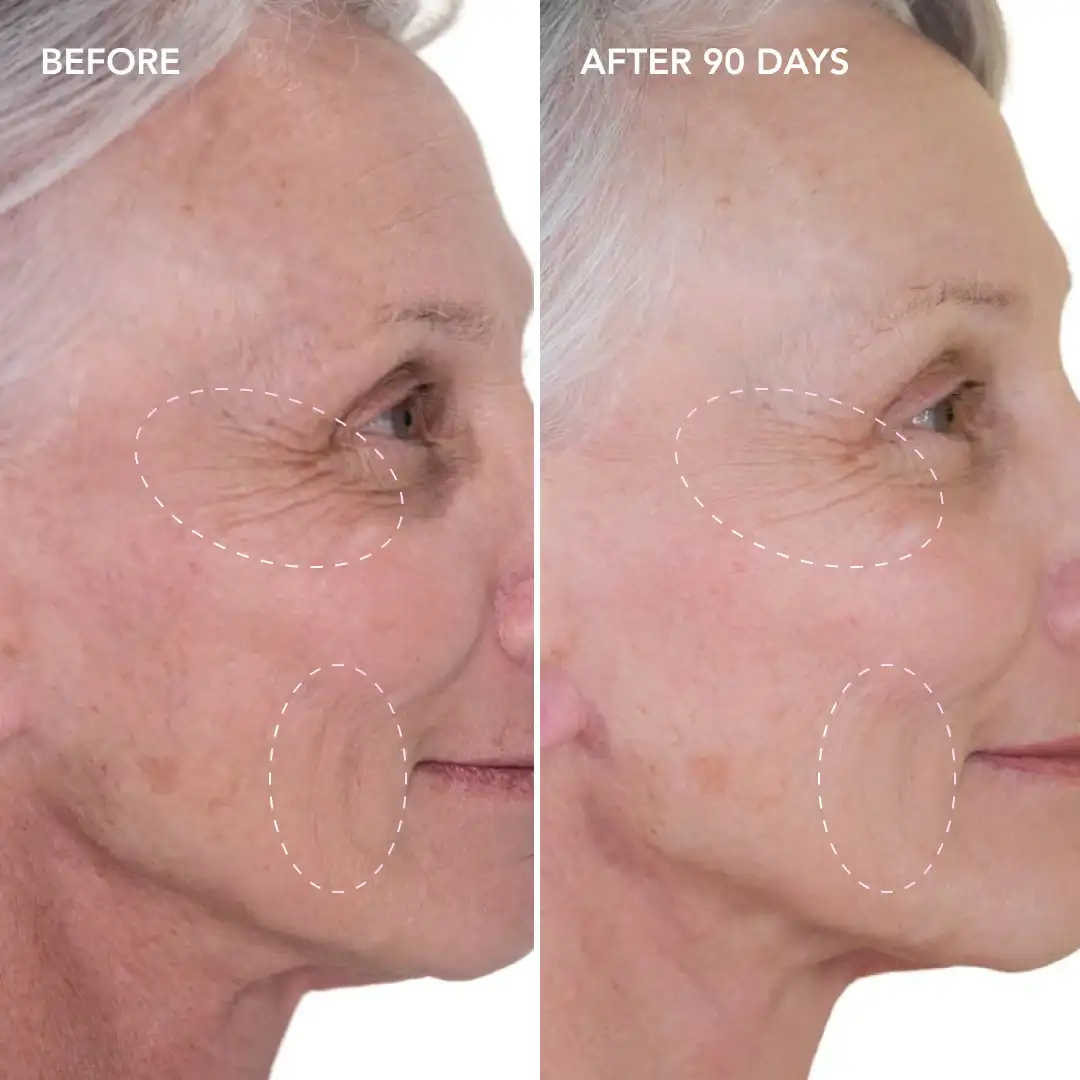 When will you see results Kingston Hill